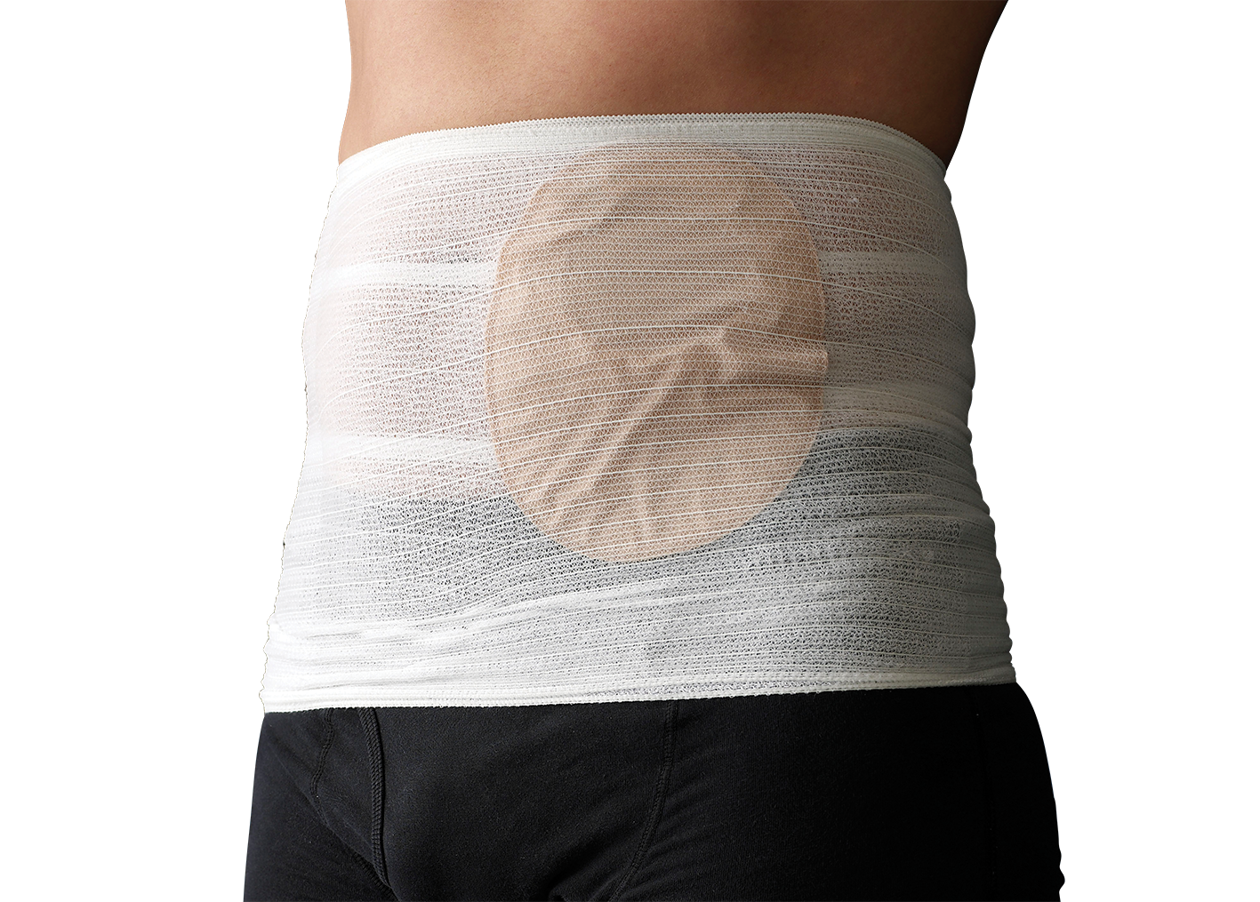 CORSINEL® Stomasafe Classic, Fixierband für Stomabeutel