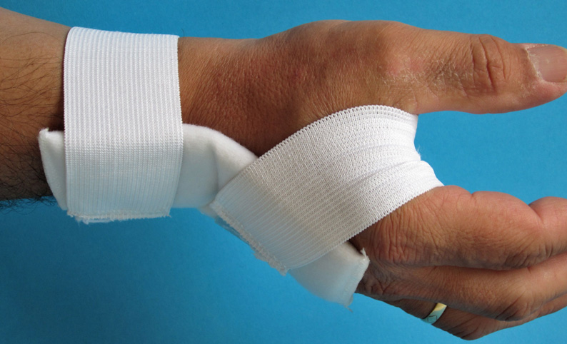 1104-2:Armschiene biegsam, Handgelenksschiene