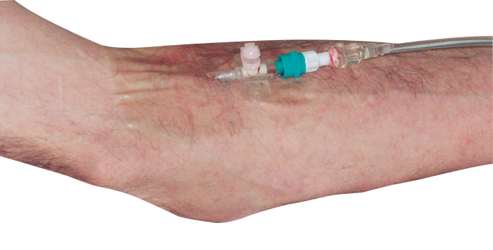 RUDAVLIES® Steril-Wundschnellverband, Vliespflaster, Wundschnellverband,Vlies, Pflaster