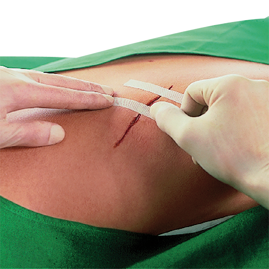 66002876:Leukostrip Wundnahtstreifen, Sterifenpflaster, Pflaster, Wundpflaster, Nahtstreifen