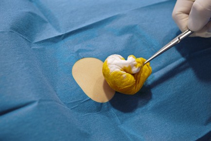 763075:NOBADRAPE® Lochtuch – selbstklebend, OP - Tuch