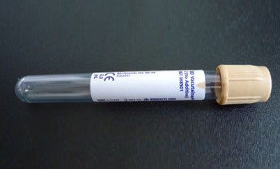 368501:Urinröhrchen, Röhrchen, Monovette