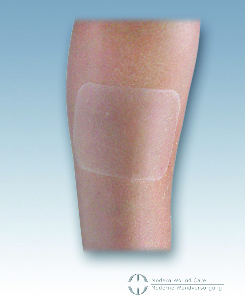 161520:Nobaderm Folienverband, Duschpflaster, Pflaster