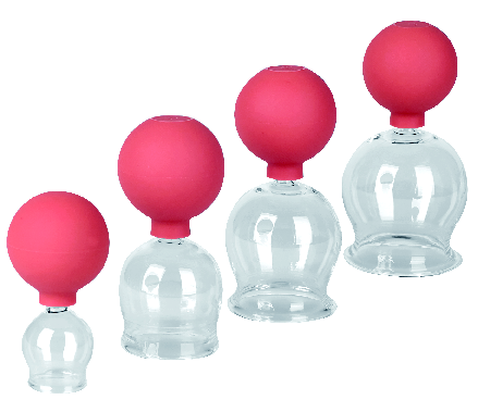 Schröpfgläser mit Gummiball, Vakuumgläser, Schröpfgefäße