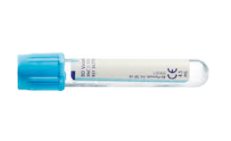 363047:BD Vacutainer Citratröhrchen 363047:BD Vacutainer Citratröhrchen